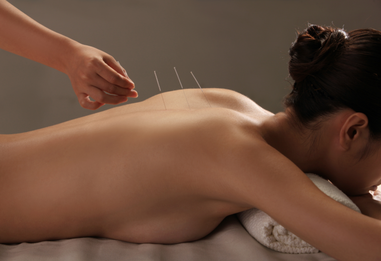 Tomber-enceinte-rapidement-_-tous-l-es-bénéfices-de-lacupuncture