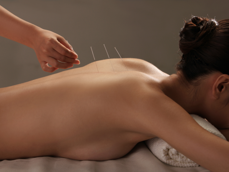 Tomber-enceinte-rapidement-_-tous-l-es-bénéfices-de-lacupuncture